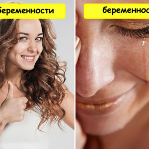 10 необычных фактов о беременности, о которых не говорят врачи