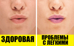 10 скрытых симптомов того, что у вас есть проблемы с легкими