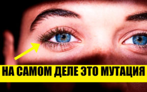 10 особенностей внешности, которыми природа награждает лишь избранных