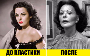 Бой за красоту: 9 актрис Голливуда, которые первыми сделали пластику