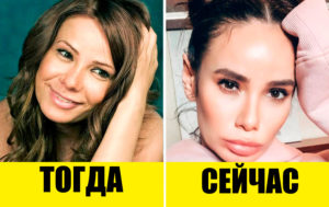 Большая ошибка: 9 звезд, которые напрасно легли под нож хирурга