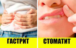 9 неожиданных болезней, передающихся через поцелуи