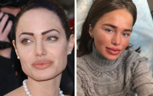 К косметологу не ходи: 9 самых опасных и бесполезных бьюти-процедур
