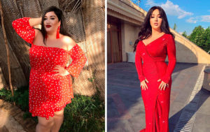 Срезали лишнее: 10 звезд, которые уменьшили размеры с помощью пластики