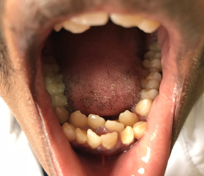 Фото: DR 10 поразительных людей с аномальным внешним видом