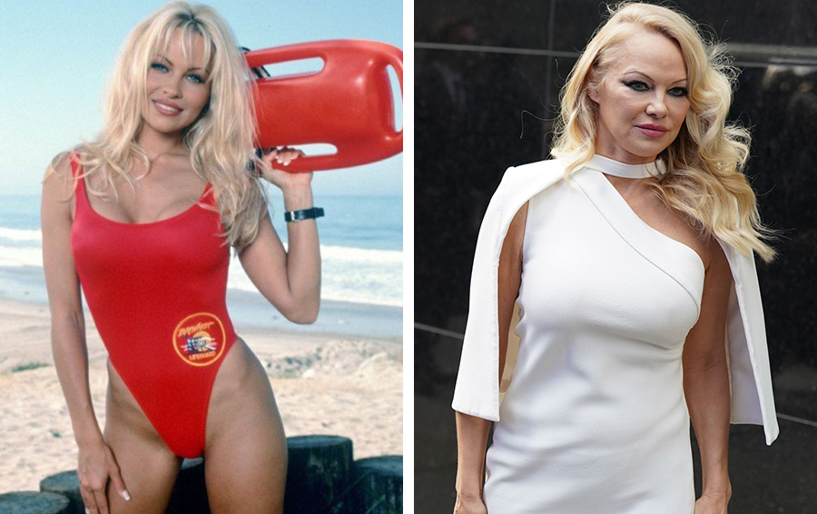 Фото: DR Памела Андерсон