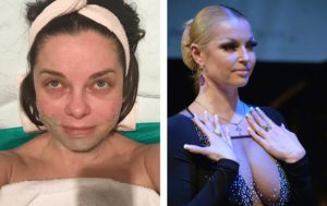 Печальный бюст, плохая кожа: 10 звёзд с заметными изъянами внешности