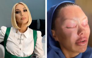 Звёздные «переделки»: 5 удачных и 5 провальных преображений