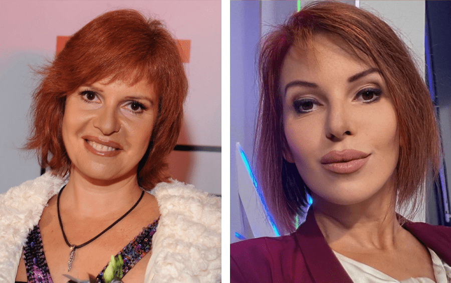 Миллионы на "лицевой" счет: 10 звёзд, "отваливших" за пластику бешеные деньги