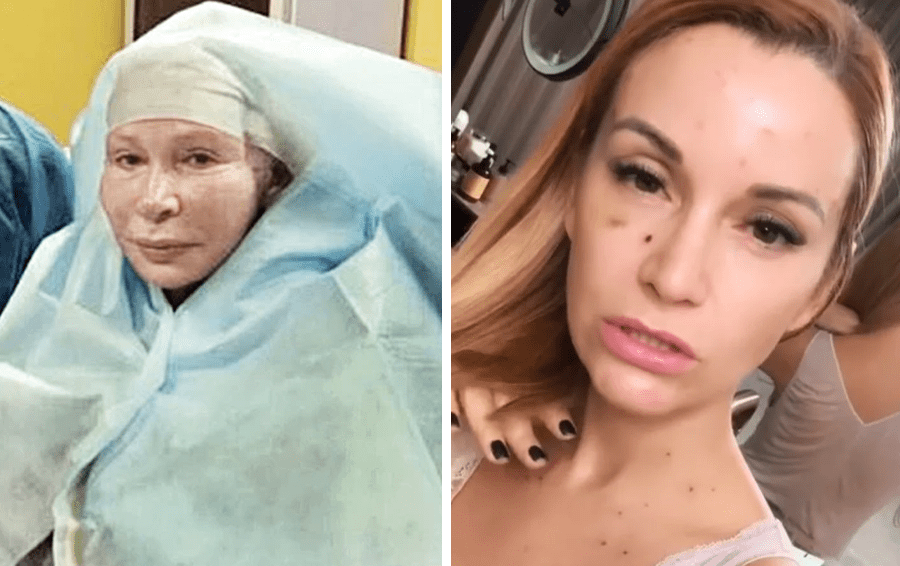 Фото: социальные сети столкнулись с осложнениями пластики