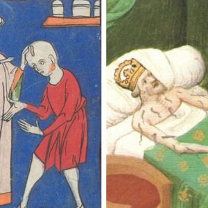 Лечение червём, платья с летальным исходом — 8 «неловких» исторических фактов