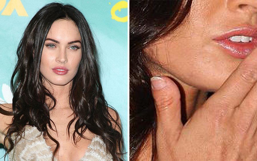 Фото: DR 10 людей с причудливыми особенностями тела