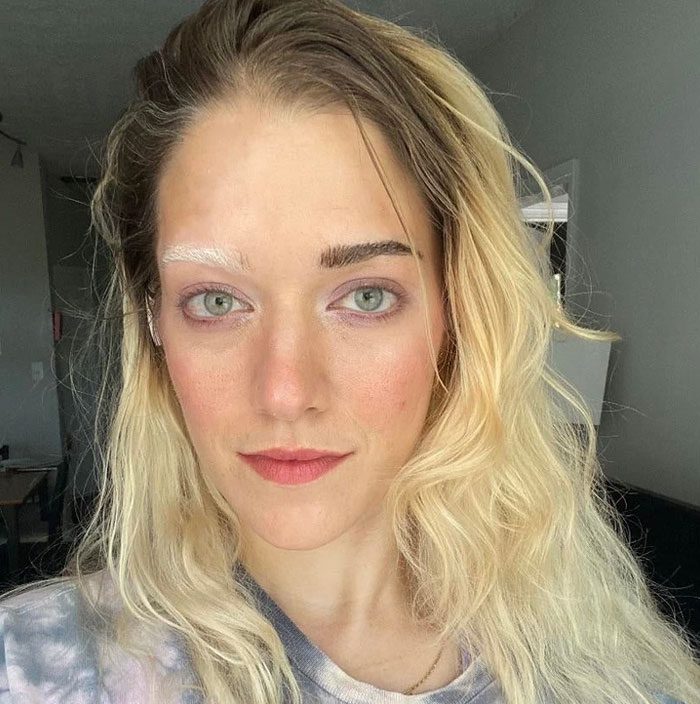 Фото: DR 10 людей с причудливыми особенностями тела