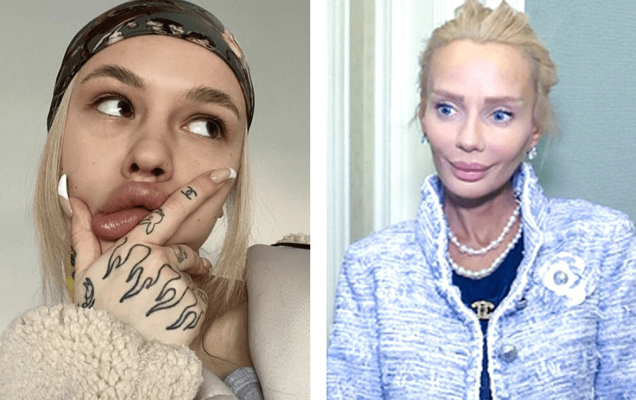 Новый нос на 14-летие