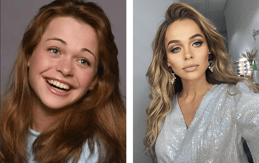 Новый нос на 14-летие