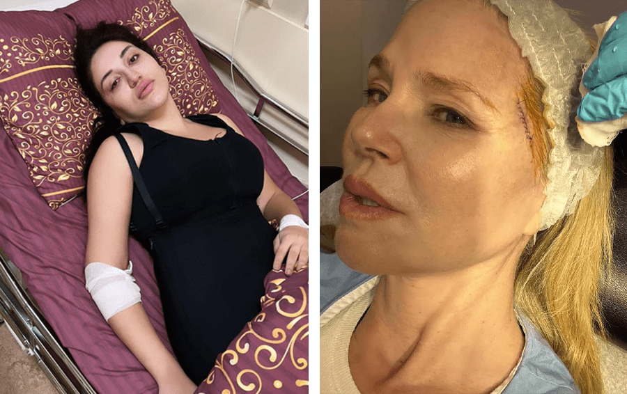 Фото: социальные сети последствия красоты