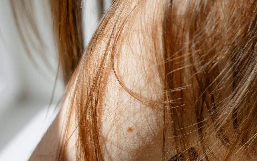 Фото: pexels Родинки меняющие цвет