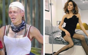 Совсем утратили красоту? 8 звёзд, чья внешность “покатилась” под откос