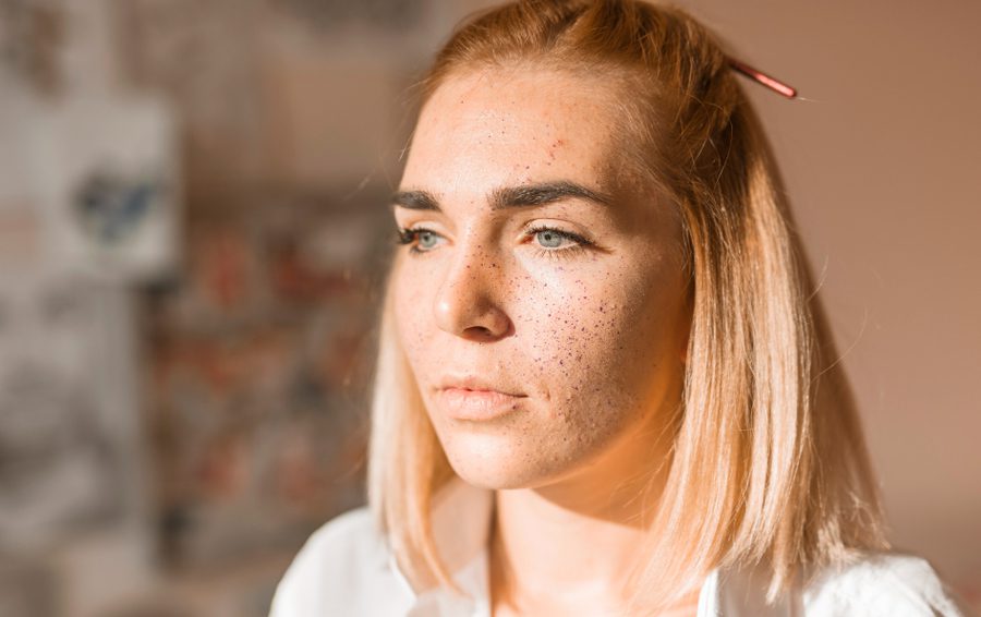 <a href="https://ru.freepik.com/free-photo/portrait-artistic-girl_3577592.htm#fromView=search&page=1&position=16&uuid=a181d06c-7f87-4128-931d-33b2af768800">Изображение от freepik</a> Ухудшение состояния кожи