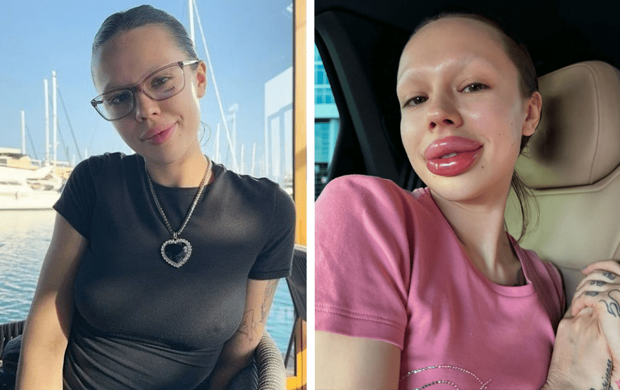 Фото: социальные сети бьюти-процедуры