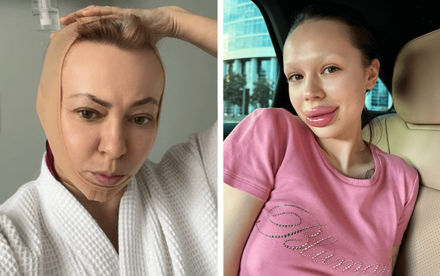 Фото: социальные сети бьюти-процедуры