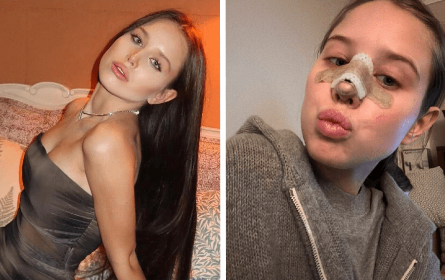 Фото: социальные сети сделали пластику в 18