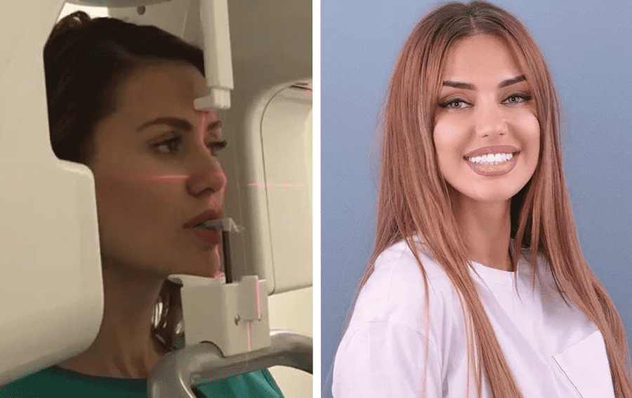 Фото: социальные сети брекеты