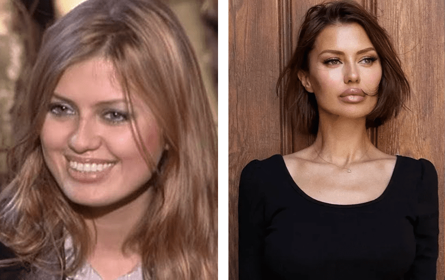 потратились на пластику