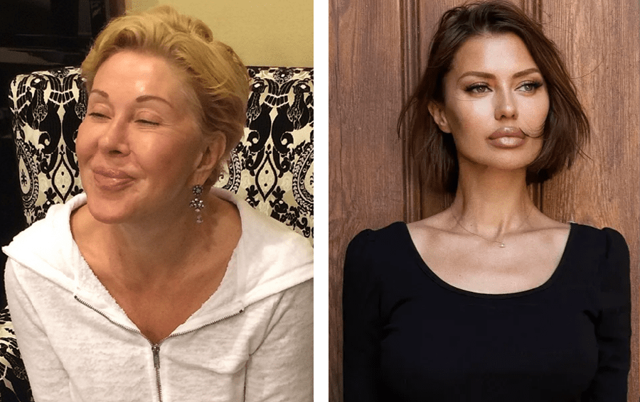 потратились на пластику