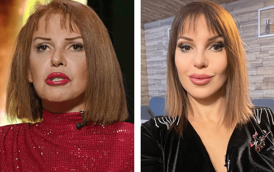 потратились на пластику