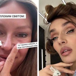 Неудачная пластика груди, зубы за 6 миллионов: 7 звёзд, пустившихся в новые «переделки» внешности