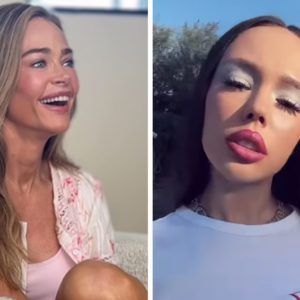Лицо «поплыло», губы «раздуло»: 7 звёзд с изменениями ‑ удачными и не очень